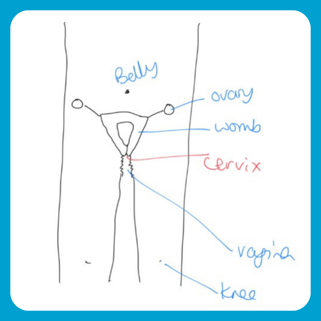 Where is your cervix A guide for trans men and non-binary people - GenderGP